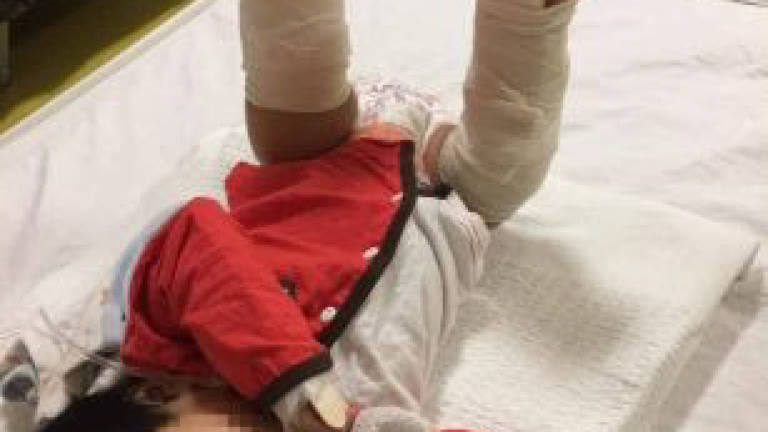 Baby suffers broken leg, police report lodged