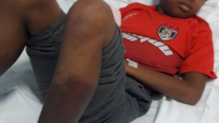 Religious school student who was beaten by assistant warden has his legs amputated