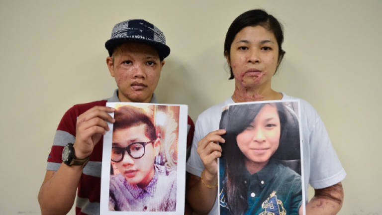 Acid attack victims get contribution for medical fund