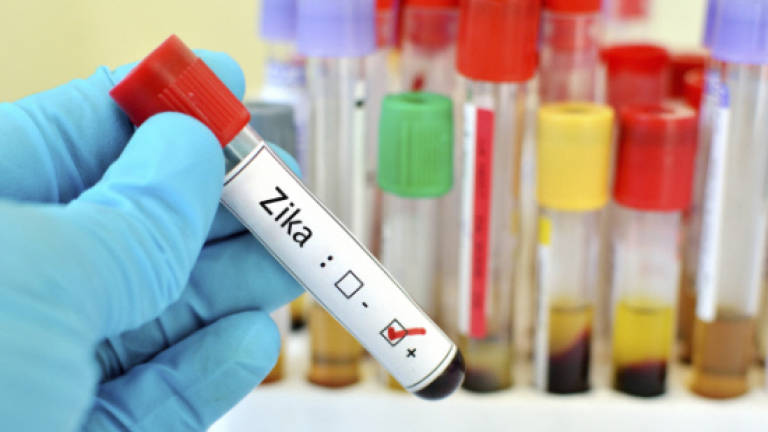 Kissing unlikely to pass on Zika virus