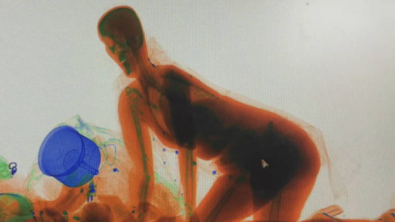 Woman crawls into x-ray machine to protect her handbag