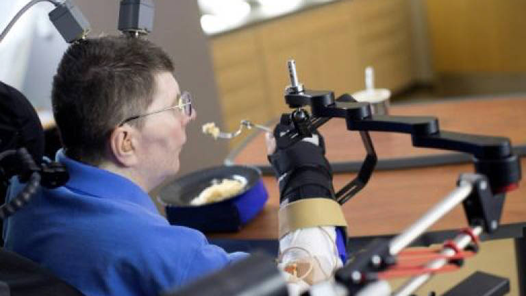 (Video) Quadriplegic man regains use of arm in medical first: Study