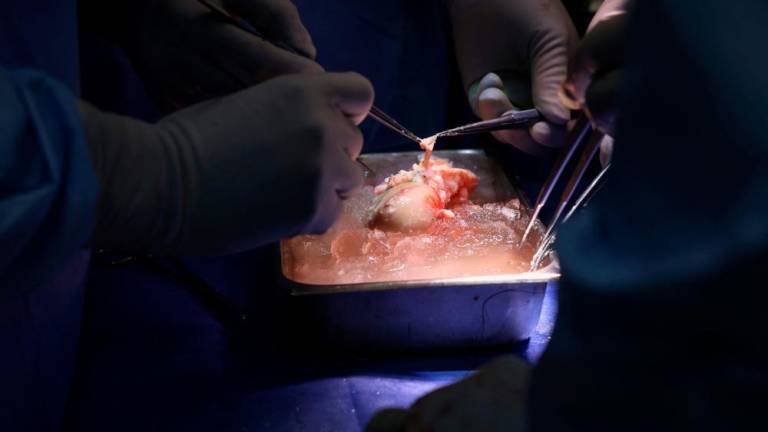 In this March 16, 2024, image courtesy of the Massachusetts General Hospital in Boston, Massachusetts, surgeons prepare the pig kidney for transplantation during the world’s first genetically modified pig kidney transplant into a living human/AFPPix