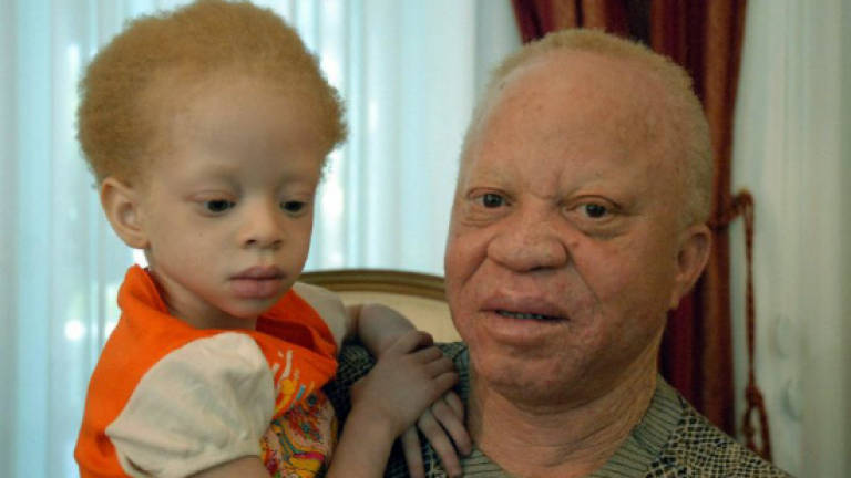 Outcry in Mali after albino child beheaded in 'ritual' murder