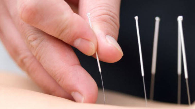 Acupuncture could reduce hot flashes associated with menopause
