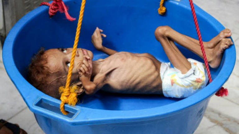 Yemen faces worsening threat of famine