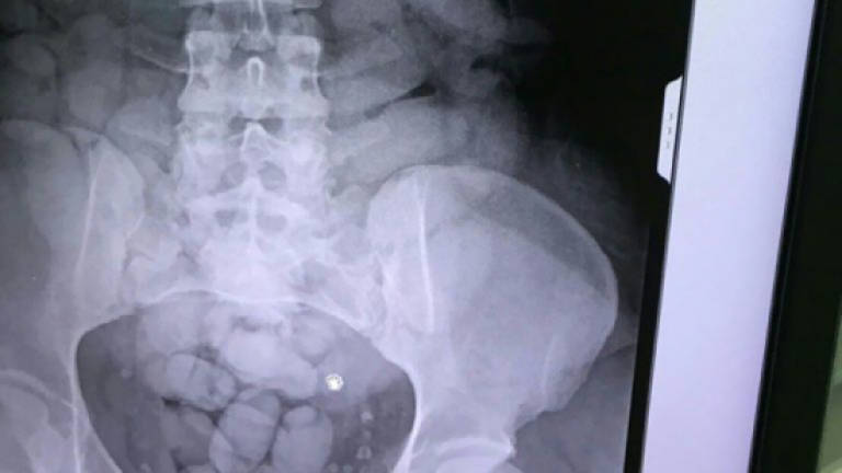 I. Coast woman who swallowed over 1kg of cocaine held at Thai airport