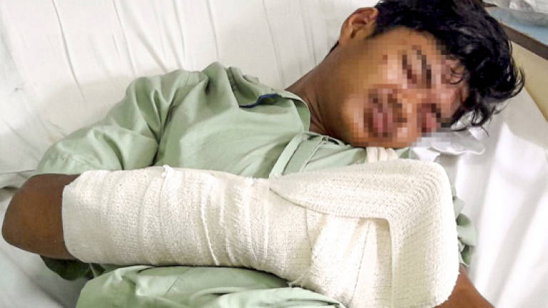 Form Five student nearly loses fingers due to playing firecrackers