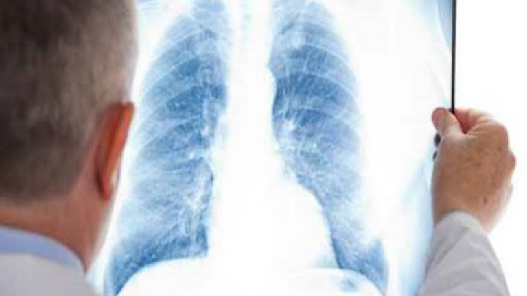 Targeted therapy slows aggressive lung cancer