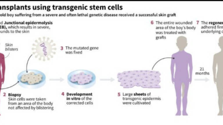 Gene therapy saves boy's skin, life