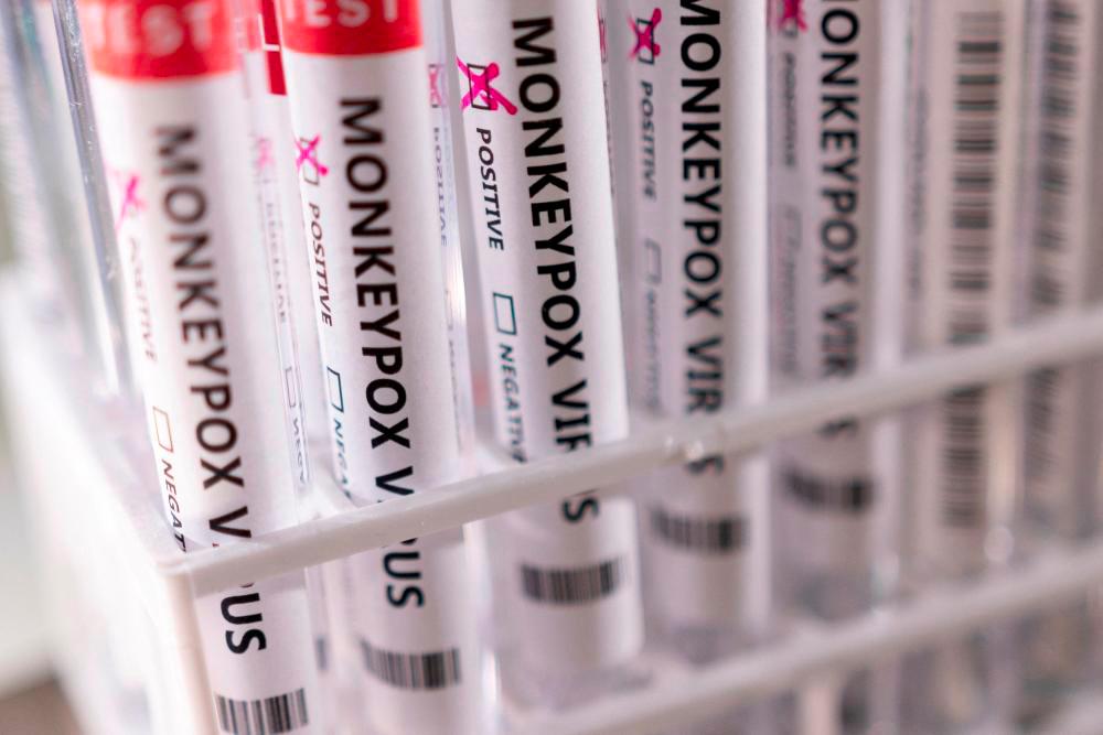 FILE PHOTO: Test tubes labelled “Monkeypox virus positive” are seen in this illustration taken May 22, 2022. - REUTERSPIX