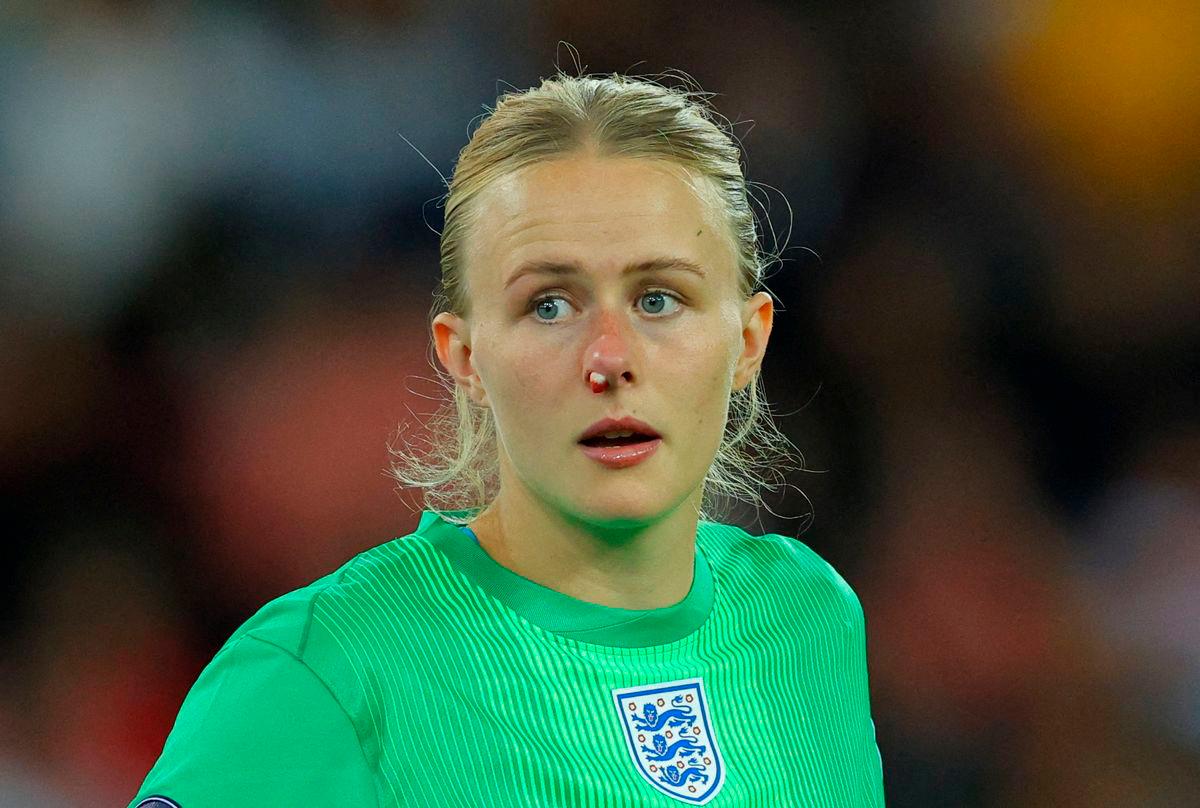 FILE PHOTO: England’s Hannah Hampton with blood on her nose- REUTERS