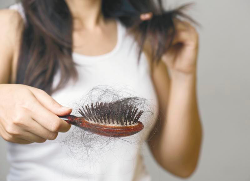 Hair loss can appear in many different ways, depending on what’s causing it. –123rf