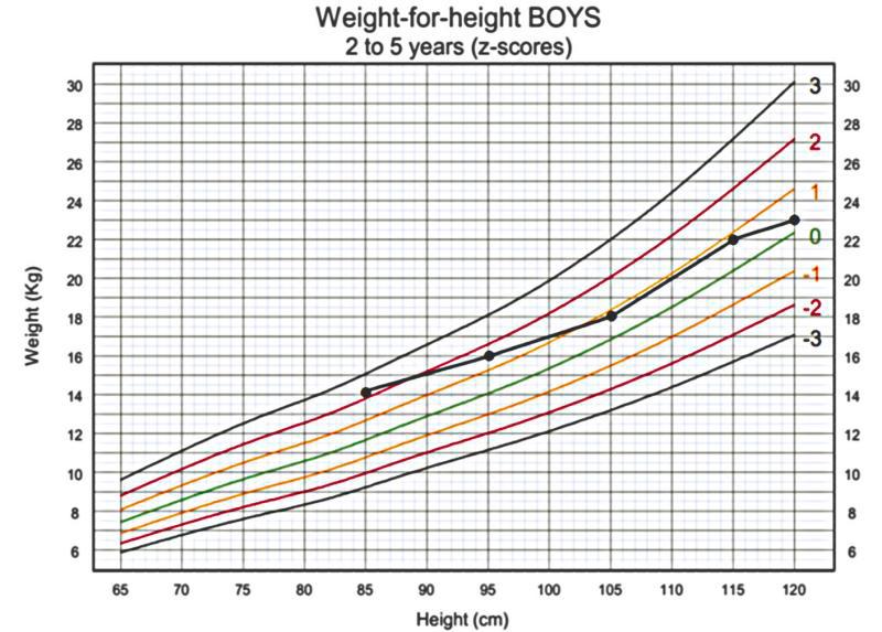 $!In this example, this boy had started off overweight (z-score +2 to +3) and the family had made changes to his diet and increased his physical activity. While there is the “crossing of lines” this is not faltering growth, and the child is now at an appropriately healthy weight.