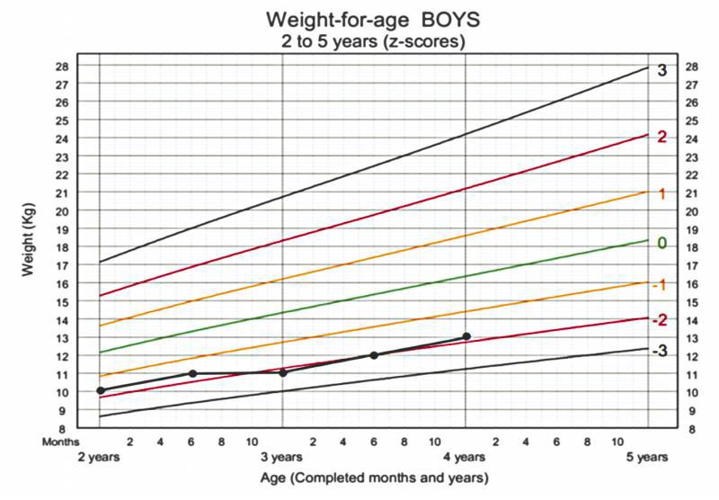 $!This chart shows a boy who is underweight but demonstrates acceptable growth velocity. While there is a brief dip in the z-score, he has largely remained in the -1 to -2 region. Gradual changes can be done to slowly improve his weight up to healthy levels.