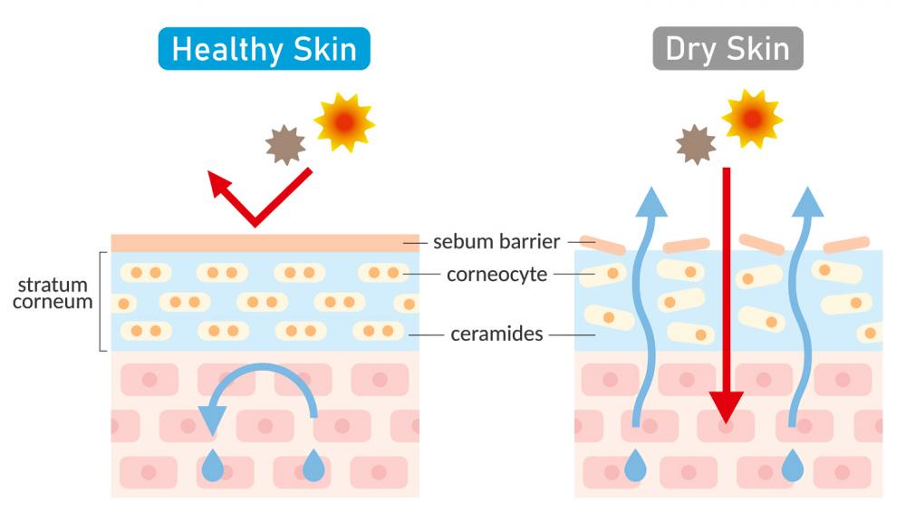 Repairing your skin barrier is key to prevent skin issues in the long run. – 123RF