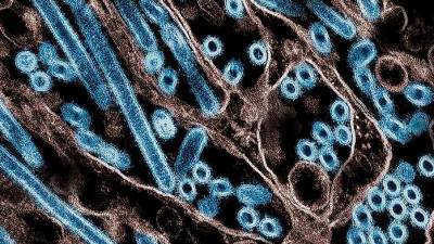 US records its first human death from bird flu