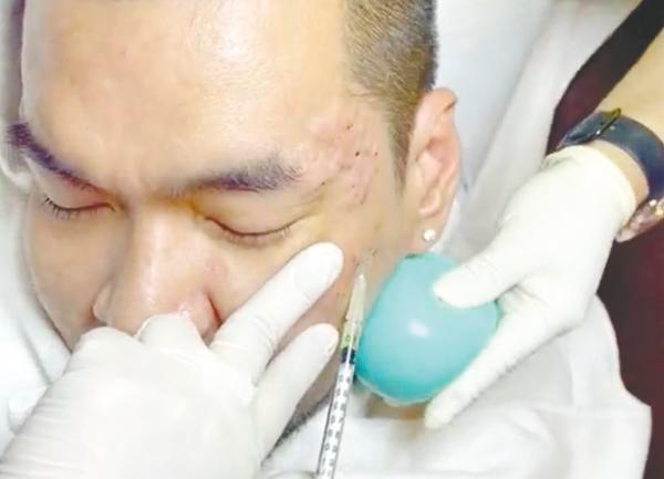 Teeba said the effectiveness of the procedure varies according to the individual and the technique used. – Pic courtesy of Vine Medical Aesthetics