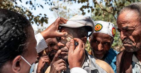 I rip out my lashes to ease pain: Eye disease afflicts Ethiopia