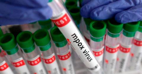 4 cases of new mpox variant reported in Germany