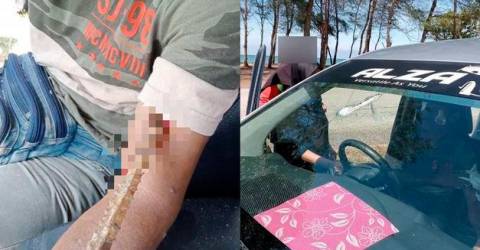 Driver almost reaches his “Final Destination” as metal rod smashes windshield, pierces arm