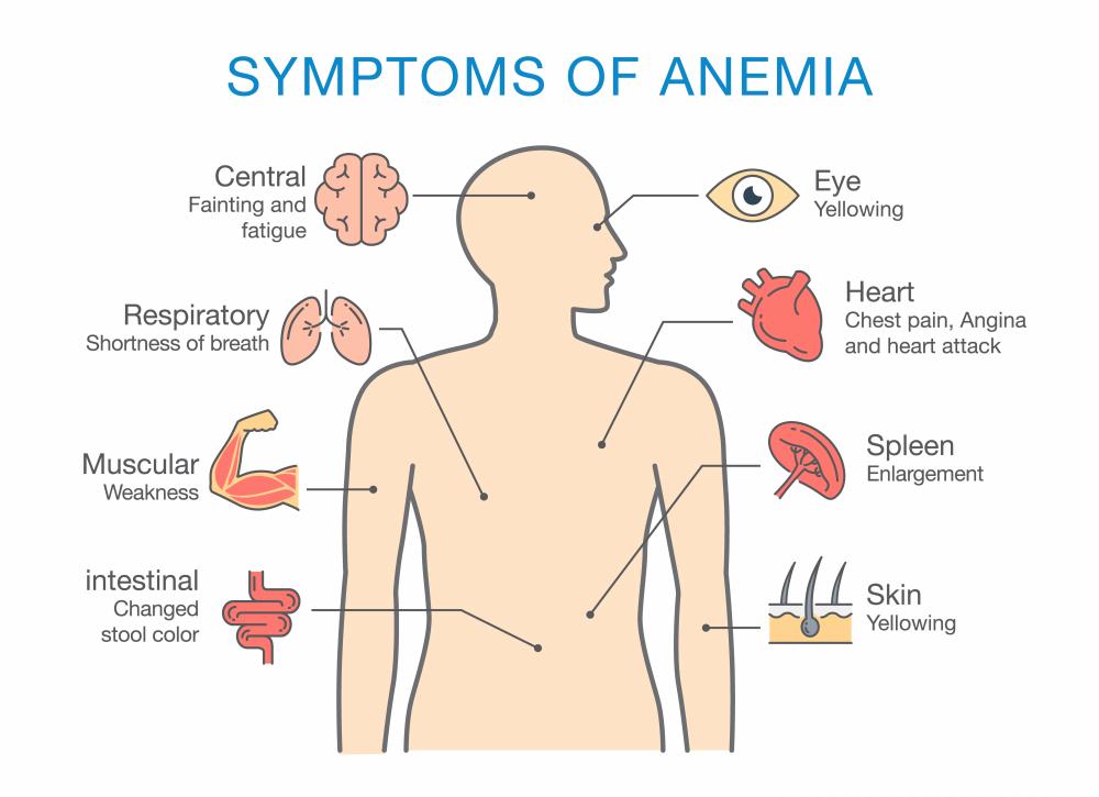 $!Some of the symptoms of anaemia.
