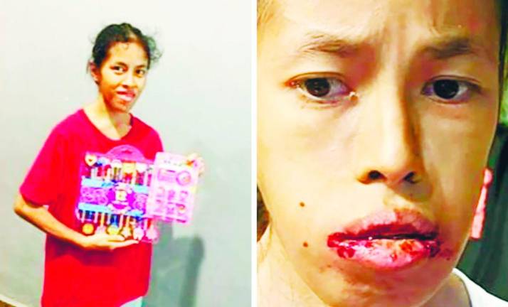 Each day without treatment weakens Amanda. – Dominic Damian pics