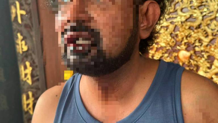 The victim suffered injuries to the mouth and wrists. - Courtesy pic