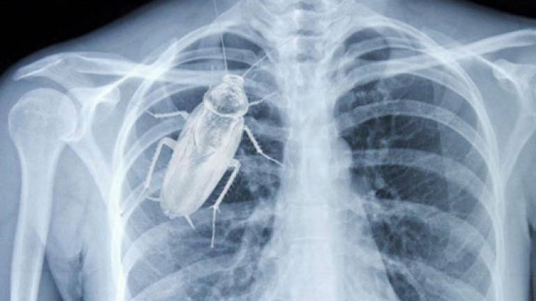 Ministry lashes out over cockroach X-ray