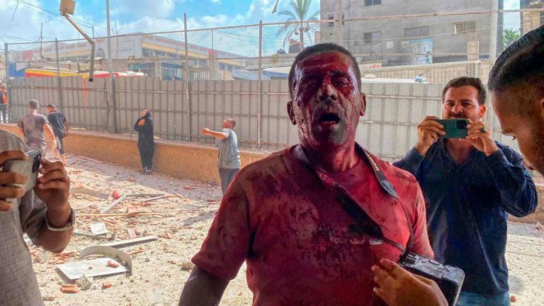 Palestinian photojournalist Hatem Omar reacts after being injured in an Israeli strike on Nasser Hospital in Khan Yunis, in the southern Gaza Strip, on August 25, 2025. An Al Jazeera journalist was killed in Gaza, a spokesperson for the Qatar-based TV network said on August 24. Mohammad Salama’s death was “confirmed”, the spokesperson said, after Al Jazeera reported he was killed in an Israeli strike. (Photo by AFP)