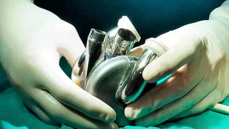 The artificial heart uses magnetic technology to “whoosh” the blood around the body instead of pumping it. (Supplied: BiVACOR via ABC Australia)