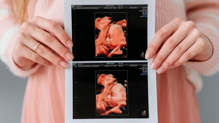 Ulltrasound examination is an opportunity for the expecting couple to see their baby that is growing in the womb. – ALL PICS FROM PEXELS