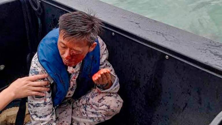 Gambar fail: Anggota Agensi Penguatkuasaan Maritim Malaysia (APMM) Bintara Muda Maritim Zainal Abad Komel, 45, yang juga ketua bot Banggi 48 cedera di mata kiri dalam kejadian tembak menembak di perairan Kunak/BERNAMAPix