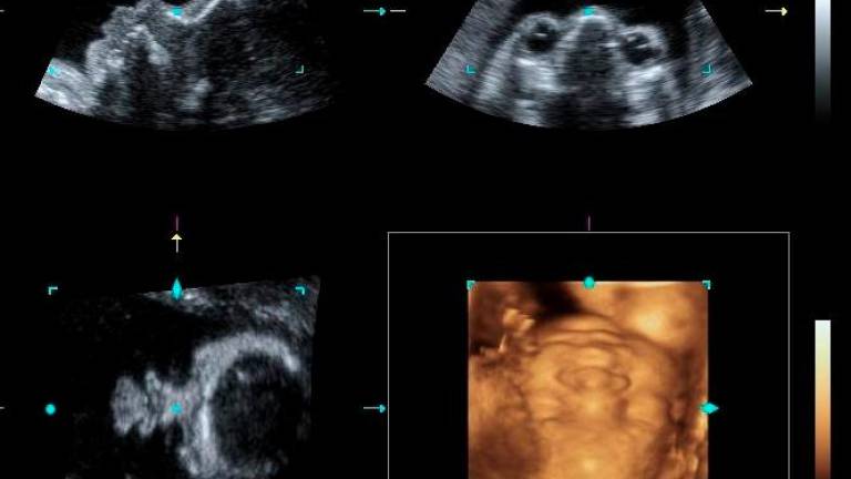 Certain abnormalities may develop later in the pregnancy period.