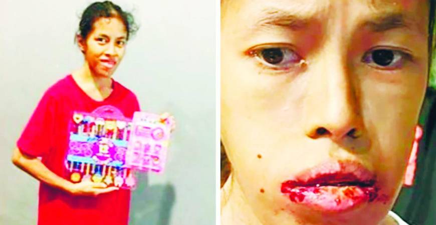 Each day without treatment weakens Amanda. – Dominic Damian pics