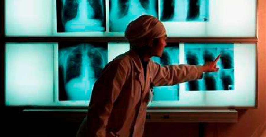 File photo shows a doctor examining an x-ray of a tuberculosis patient at the Beijing Tuberculosis Hospital/REUTERSPIX