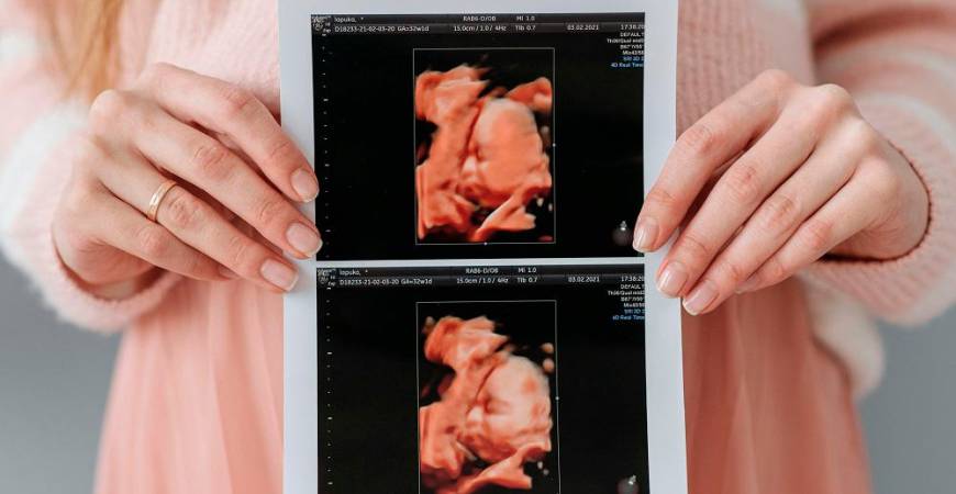 Ulltrasound examination is an opportunity for the expecting couple to see their baby that is growing in the womb. – ALL PICS FROM PEXELS