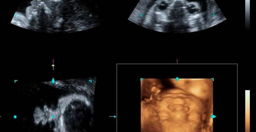 Certain abnormalities may develop later in the pregnancy period.