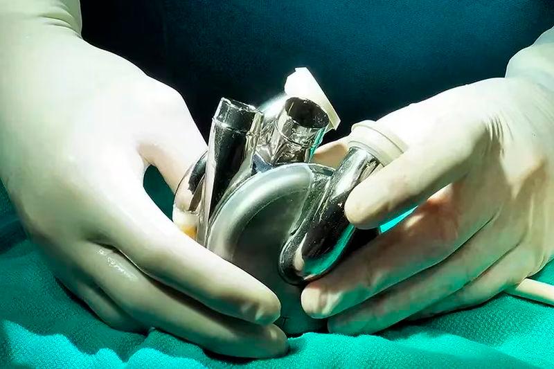 The artificial heart uses magnetic technology to “whoosh” the blood around the body instead of pumping it. (Supplied: BiVACOR via ABC Australia)