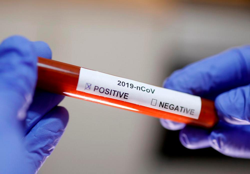 Test tube with Corona virus name label is seen in this illustration taken on January 29, 2020. — Reuters
