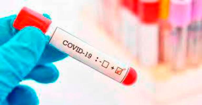 Malaysia's Covid-19 infectivity up slightly at 1.16 :Health DG