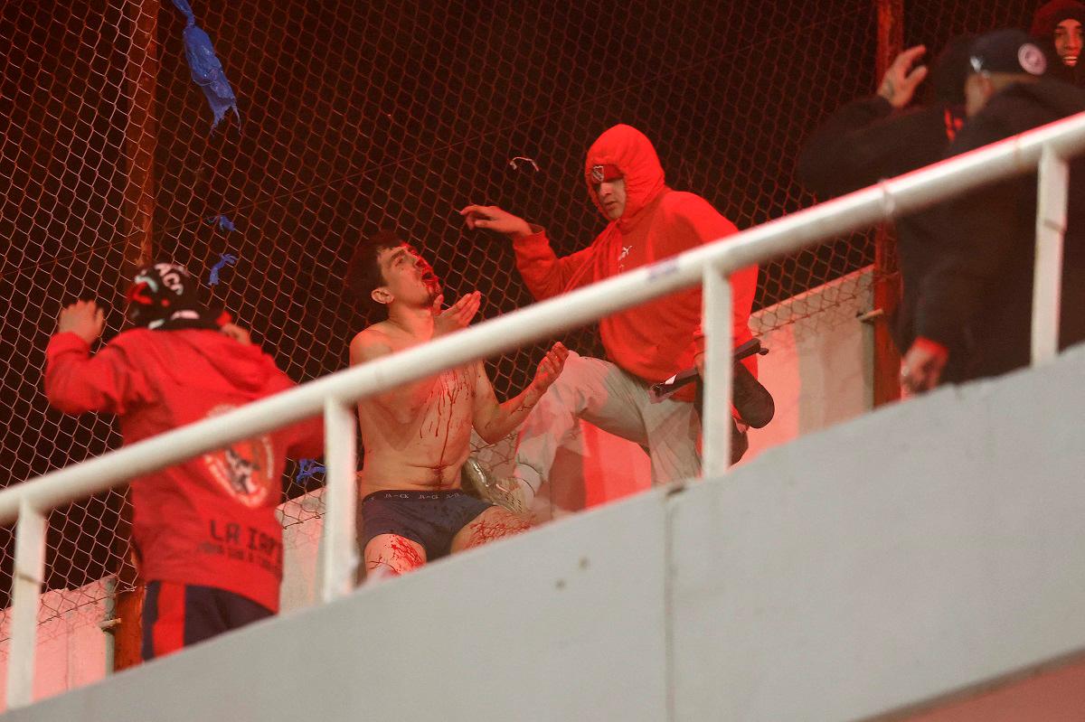 A man bleeds during the interruption of the Copa Sudamericana round of 16 second leg football match between Argentina’s Independiente and Chile’s Universidad de Chile at the Libertadores de America stadium in Avellaneda, Buenos Aires province, Argentina on August 20, 2025. - Alejandro PAGNI / AFP
