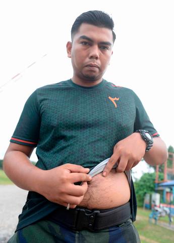 GOF personnel Lance Corporal Muhammad Amirul Amir showing the slight injury on his stomach.-Bernama