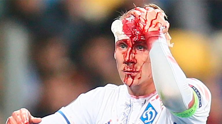 Football's head injury policy a 'shambles': brain specialist