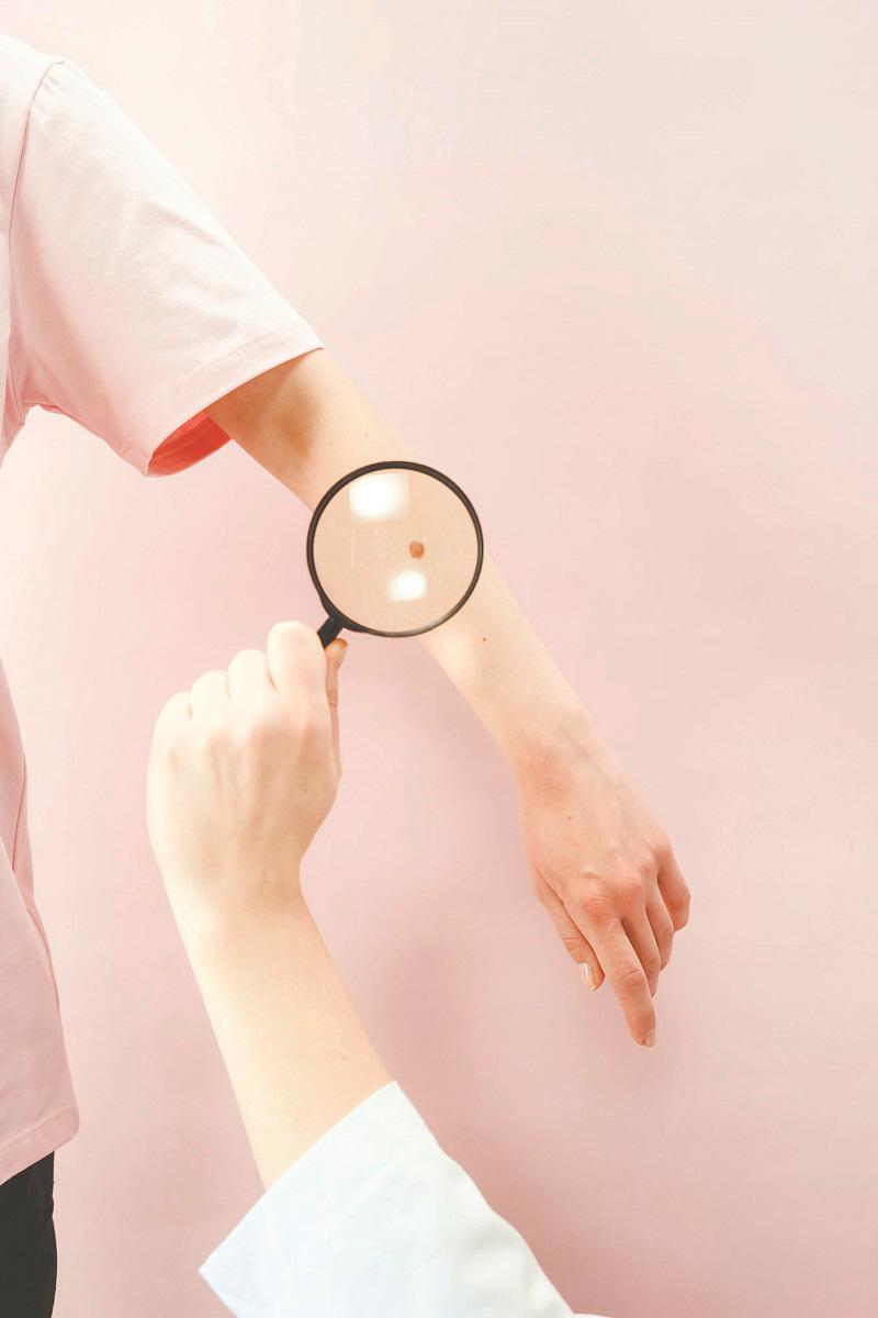 $!Anaemia may cause some women to appear pale during pregnancy. – ALL PICS FROM PEXELS