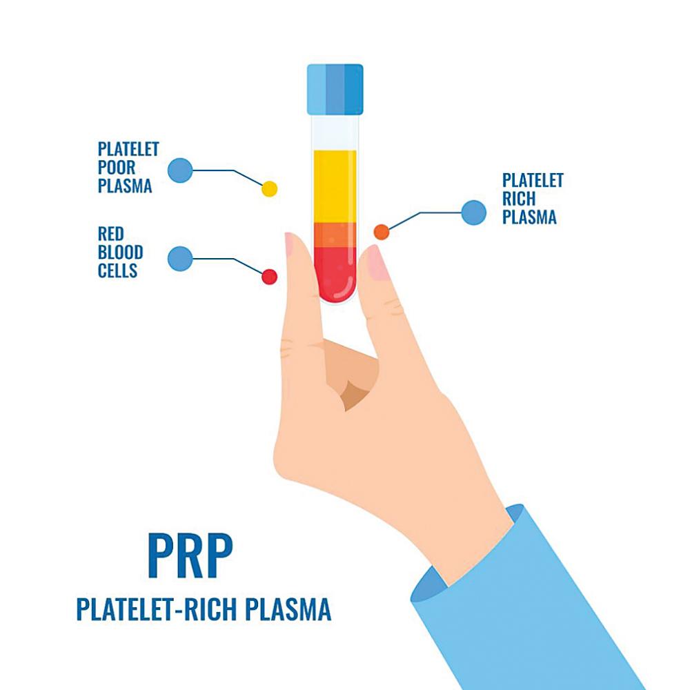 $!PRP is produced after extracted blood is spun in a centrifuge. – Canada Med Laser