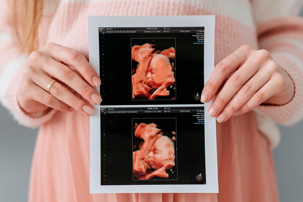 Ulltrasound examination is an opportunity for the expecting couple to see their baby that is growing in the womb. – ALL PICS FROM PEXELS