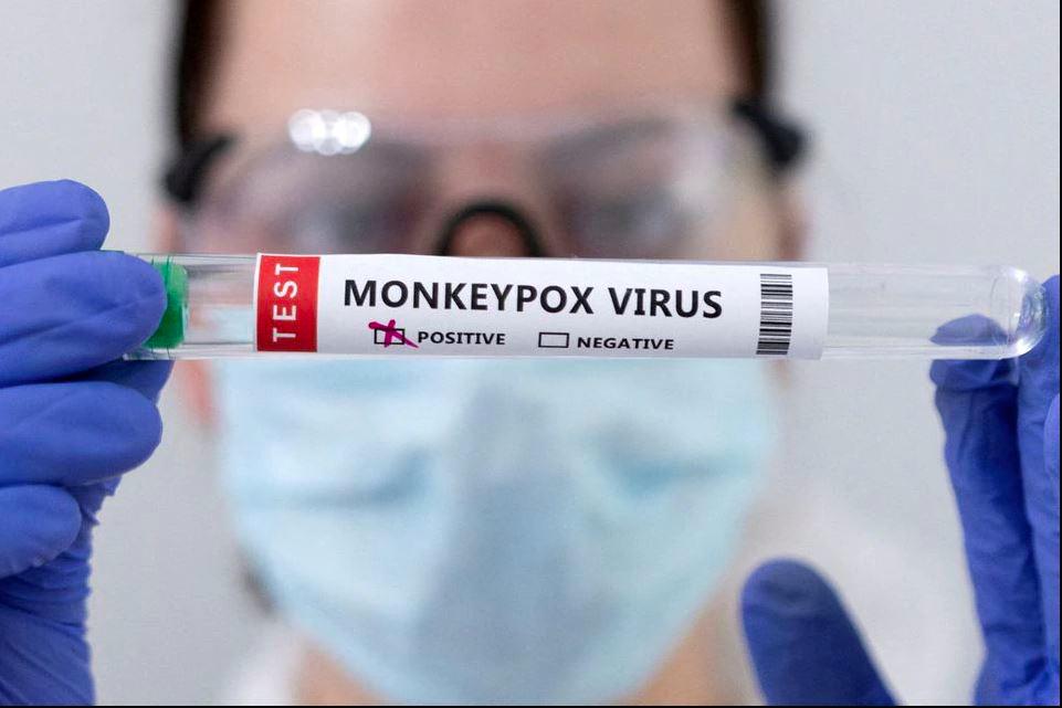 Test tubes labelled “Monkeypox virus positive” are seen in this illustration taken May 23, 2022. - REUTERSPIX
