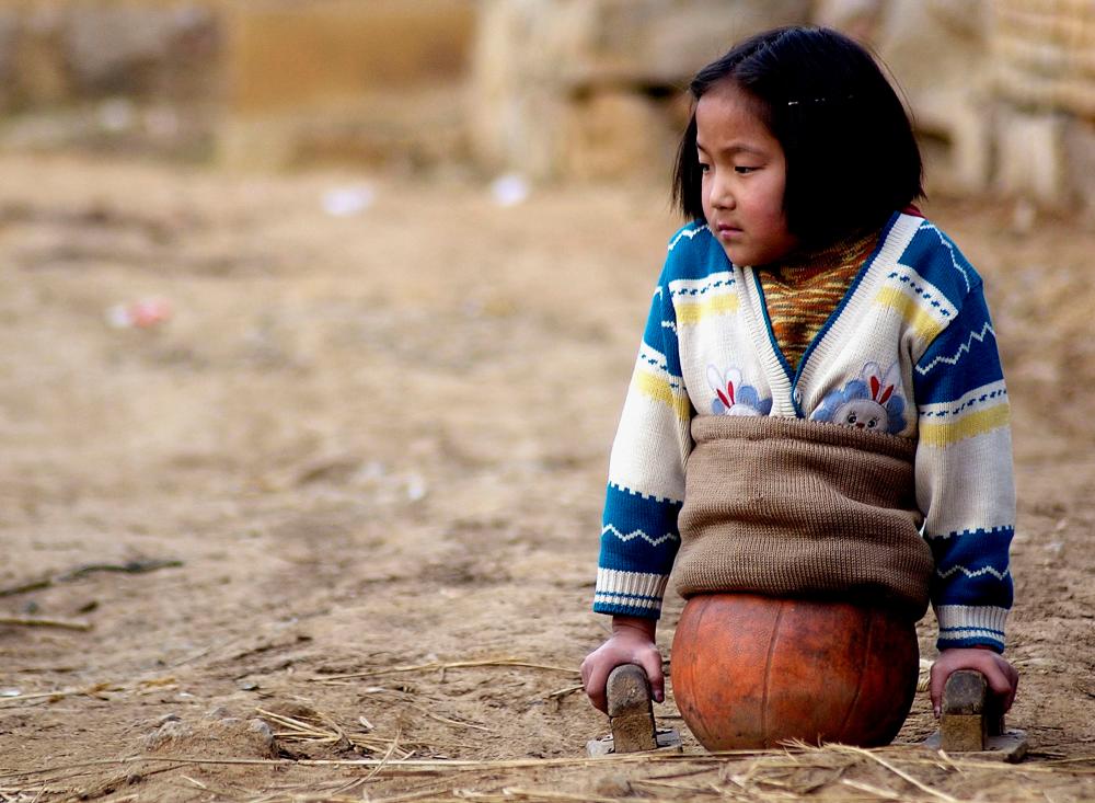 Qian Hongyan used to walk using her hands, while balancing on a basketball – Newsweek