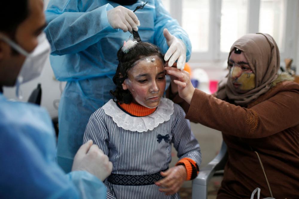 Palestinian Maram and her mother Izdihar al-Amawi suffering from severe facial burns get fitted with a 3D-printed transparent face mask at a clinic run by the Doctors Without Borders (Medecins Sans frontieres - MSF) international healthcare charity in Gaza City, on February 22, 2021. - AFP